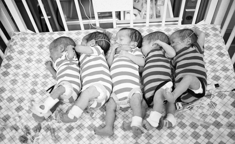 Egyptian Woman Gives Birth to 4 Girls and 1 Boy in Unusual Quintuplets Case