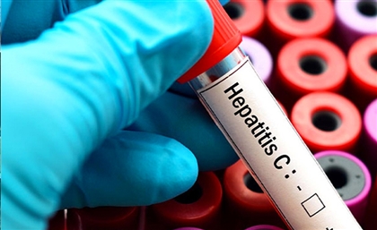 Ministry of Health Declares Egypt First Nation to Wipe Out Hepatitis C